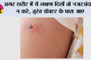 Dengue Symptoms: अगर शरीर में ये लक्षण दिखें तो नजरअंदाज न करे, तुरंत डॉक्टर के पास जाए