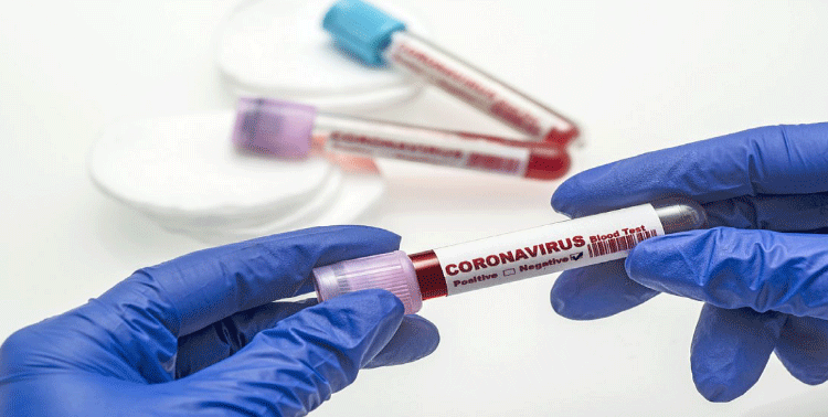 देश में कोरोना संक्रमण के नये मामले फिर बढ़े, संक्रमितों की संख्या 1.58 लाख पर