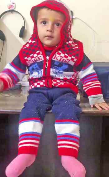 16 करोड़ के टीके से अब अयांश की सेहत में सुधार