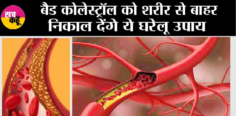 Control Bad Cholesterol: बैड कोलेस्ट्रॉल को शरीर से बाहर निकाल देंगे ये घरेलू उपाय