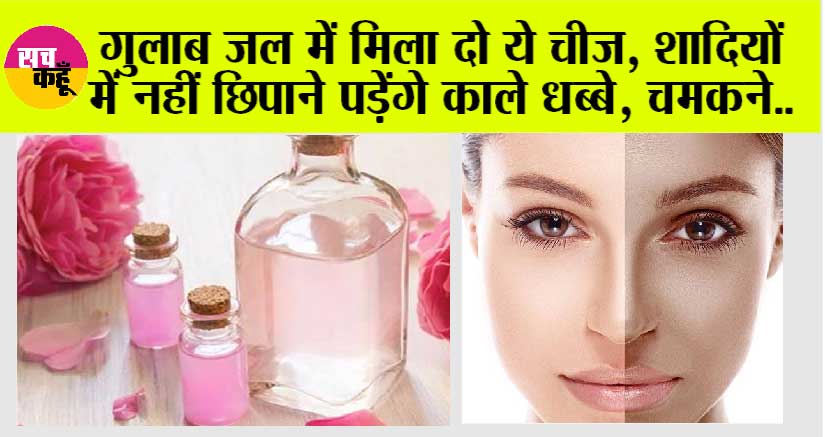 Gulab Jal Face Pack: अपनी स्किन को ग्लोइंग और चमकदार बनाने के लिए करें गुलाब जल का इस्तेमाल, जानें यूज करने का तरीका