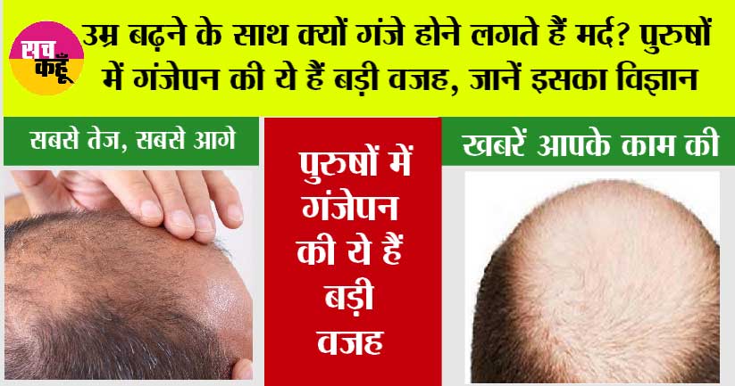 Hair Care: उम्र बढ़ने के साथ क्‍यों गंजे होने लगते हैं मर्द? पुरुषों में गंजेपन की ये हैं 5 बड़ी वजह, जानें इसका व‍िज्ञान
