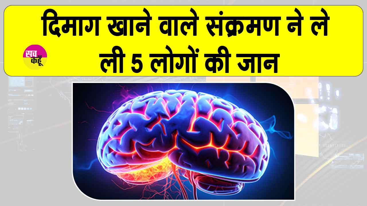 Brain eating amoeba: दिमाग खाने वाले अमीबा ने ली महिला की जान, मृतकों की संख्या पहुंची 5