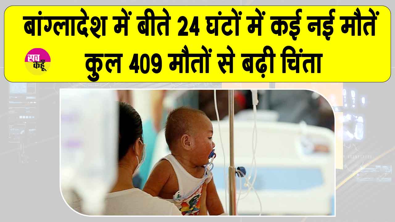 बांग्लादेश में खसरा गंभीर, कुल 409 मौतों से बढ़ी चिंता