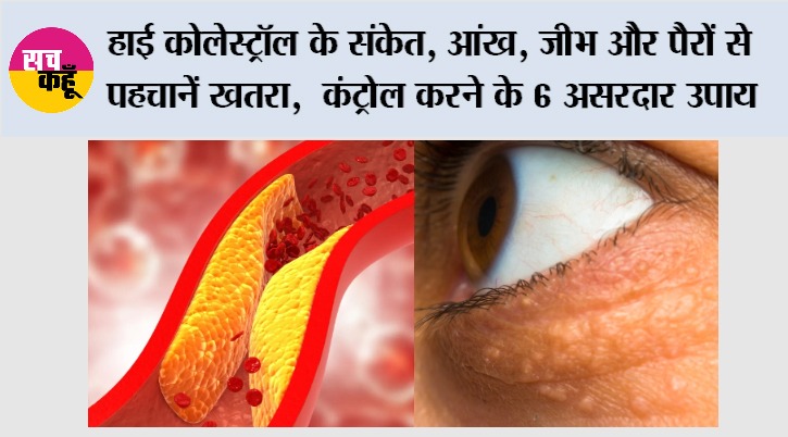 High Cholesterol Symptoms: हाई कोलेस्ट्रॉल के संकेत, आंख, जीभ और पैरों से पहचानें खतरा,  कंट्रोल करने के 6 असरदार उपाय