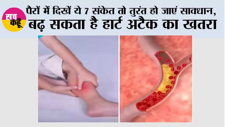 High Cholesterol Symptoms: पैरों में दिखें ये 7 संकेत तो तुरंत हो जाएं सावधान, बढ़ सकता है हार्ट अटैक का खतरा