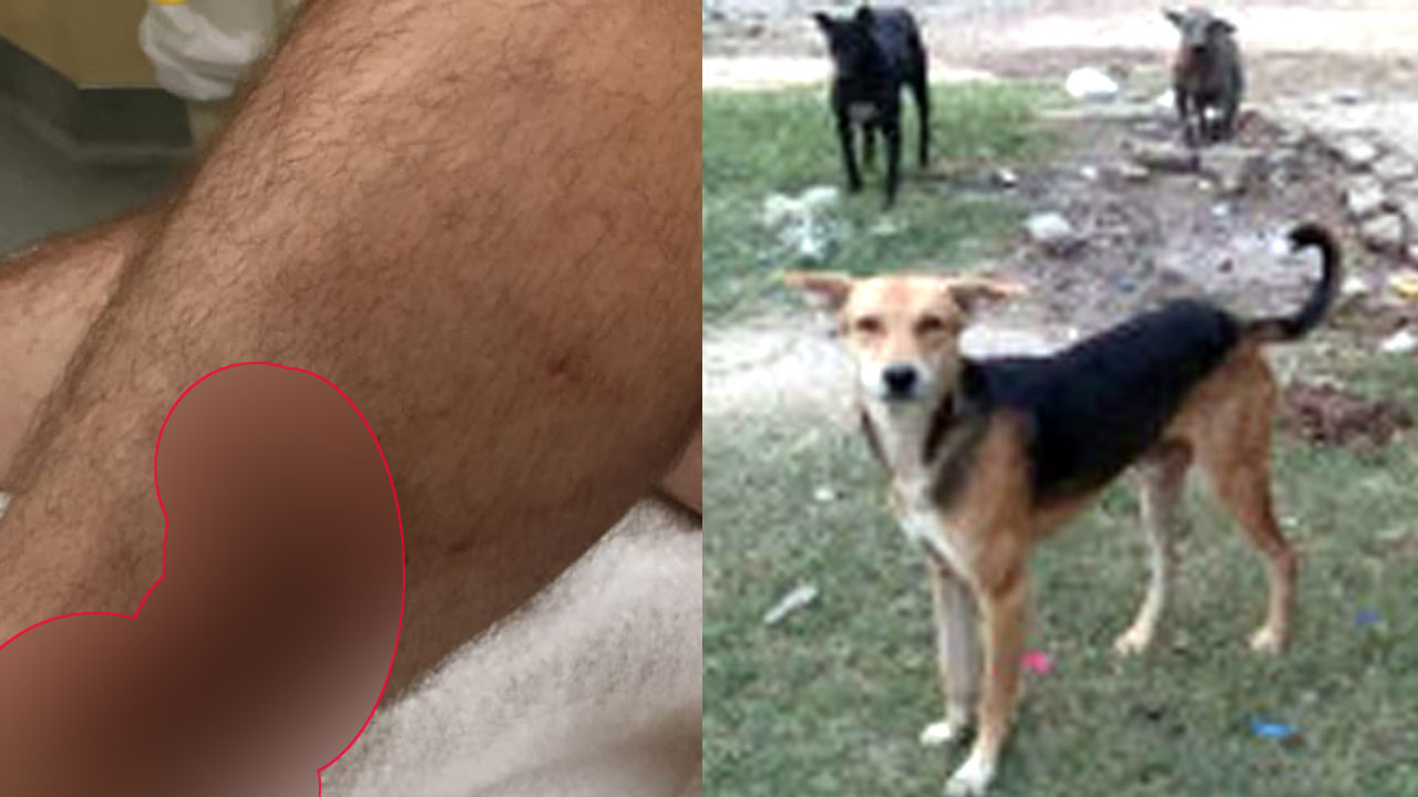 Dog Bite News: जनगणना ड्यूटी के दौरान अध्यापक को कुत्ते ने काटा