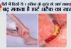 High Cholesterol Symptoms: पैरों में दिखें ये 7 संकेत तो तुरंत हो जाएं सावधान, बढ़ सकता है हार्ट अटैक का खतरा