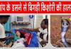 Snake News: सो रही 14 वर्षीय किशोरी को जहरीले सांप ने डसा, अस्पताल में भर्ती, हालत गंभीर