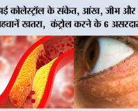 High Cholesterol Symptoms: हाई कोलेस्ट्रॉल के संकेत, आंख, जीभ और पैरों से पहचानें खतरा,  कंट्रोल करने के 6 असरदार उपाय