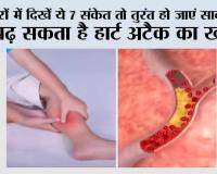 High Cholesterol Symptoms: पैरों में दिखें ये 7 संकेत तो तुरंत हो जाएं सावधान, बढ़ सकता है हार्ट अटैक का खतरा