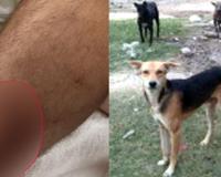 Dog Bite News: जनगणना ड्यूटी के दौरान अध्यापक को कुत्ते ने काटा