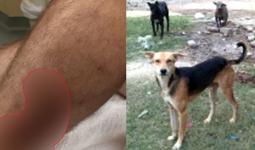 Dog Bite News: जनगणना ड्यूटी के दौरान अध्यापक को कुत्ते ने काटा