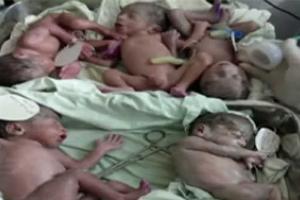 जयपुर में जब 5 बच्चों को महिला ने दिया जन्म
