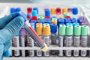 सीरिया में कोरोना के 61 नये मामले, संक्रमितों की संख्या 1060 हुई