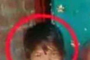 एम्स में पांच साल की ब्रेन डेड बच्ची का लीवर, किडनी व कॉर्निया दान