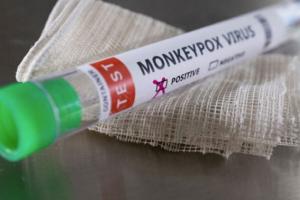 कोलंबिया में मंकीपॉक्स संक्रमण के मामले बढ़कर 273