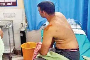 बिजली सप्लाई ठीक करने पहुंचे लाइनमैन पर लाठी-डंडों से हमला