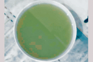 समस्या: सीवरेज युक्त पानी पीने को मजबूर साऊथ एवेन्यू के निवासी