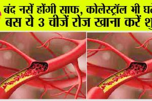 Cholesterol Control: बंद नसें होंगी साफ़, कोलेस्ट्रॉल भी घटेगा, बस ये 3 चीज़ें रोज़ खाना करें शुरू