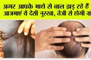 Hair Fall: अगर आपके माथे से बाल झड़ रहे हैं तो आजमाएं ये देसी नुस्खा, तेजी से आएंगे बाल