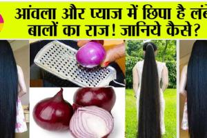 Hair Growth: आंवला और प्याज, इनमें छिपा है लंबे बालों का राज! जानिये कैसे?