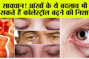 High Cholesterol Symptoms: आंखों की ऐसी रूपरेखा, ना करें अनदेखा, ऐसे परिवर्तन, हो सकते हैं कोलेस्ट्रॉल बढ़ने के लक्षण