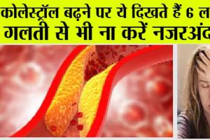 High Cholesterol: कोलेस्ट्रोल बढ़ने पर शरीर देता है ये संकेत, गलती से भी ना करें नजरअंदाज