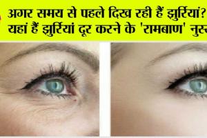 Skin Care: अगर समय से पहले दिख रही हैं झुर्रियां? तो यहां हैं झुर्रियां दूर करने के ‘रामबाण’ नुस्खे!