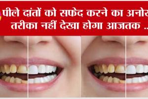 White Teeth: पीले दांतों को सफ़ेद करने का अनोखा तरीक़ा नहीं देखा होगा आजतक …