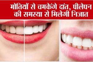 Yellow Teeth Home Remedies: मोतियों से चमकेंगे दांत, पीलेपन की समस्या से मिलेगी निजात