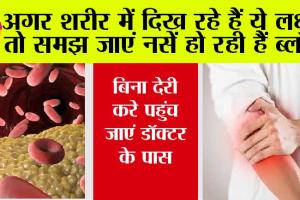 Clogged Arteries: अगर शरीर में दिख रहे हैं ये लक्षण तो समझ जाएं नसें हो रही हैं ब्लॉक, बिना देरी करे पहुंच जाएं डॉक्टर के पास