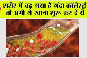 High Cholesterol Control: नसों में बैड कोलेस्ट्रॉल का जमना है जानलेवा, इन चीजों को खाकर कम कर सकते हैं कोलेस्ट्रॉल लेवल
