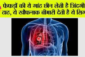 Lungs Problem: फेफड़ों की ये गांठ छीन लेती है जिंदगी के ठाठ, ये खौफनाक बीमारी देती है ये सिग्नल