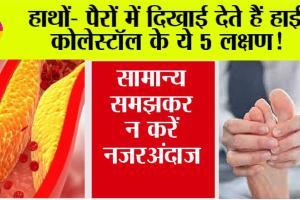 High Cholesterol Symptoms: शरीर में कोलेस्ट्रॉल बढ़ने पर हाथ-पैरों में नजर आते हैं ये लक्षण, इसे न करें नजरअंदाज, वरना…