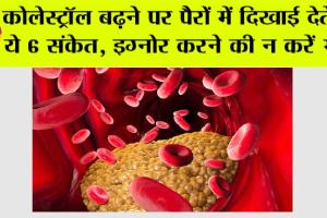 Cholesterol Symptoms: कोलेस्ट्रॉल बढ़ने पर पैरों में दिखाई देते हैं ये 6 संकेत, इग्नोर करने की न करें भूल