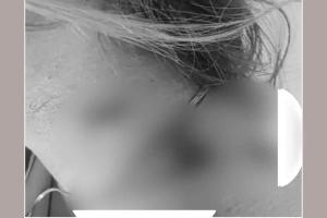 Beauty Parlour Firing: ब्यूटी पार्लर संचालिका पर चलाई गोली, कंधे और गर्दन को छूकर निकल गई गोली