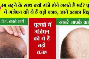 Hair Care: उम्र बढ़ने के साथ क्‍यों गंजे होने लगते हैं मर्द? पुरुषों में गंजेपन की ये हैं 5 बड़ी वजह, जानें इसका व‍िज्ञान