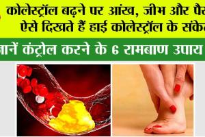 High Cholesterol: कोलेस्ट्रॉल बढ़ने पर आंख, जीभ और पैरों में ऐसे दिखते हैं हाई कोलेस्ट्रॉल के संकेत, जानें कंट्रोल करने के 6 रामबाण उपाय