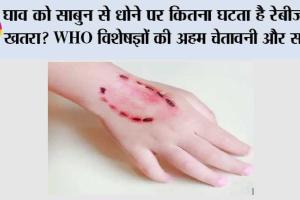 Dog Bite: घाव को साबुन से धोने पर कितना घटता है रेबीज का खतरा? WHO विशेषज्ञों की अहम चेतावनी और सलाह