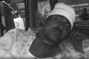 Diamond Harbour attack: भाजपा कार्यकर्ता मना रहे थे एनडीए की जीत का जश्न, अचानक कर दिया 40-50 लोगों ने हमला