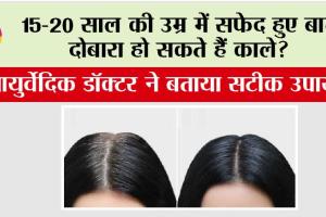 White Hair: 15-20 साल की उम्र में सफेद हुए बाल दोबारा हो सकते हैं काले? आयुर्वेदिक डॉक्टर ने बताया सटीक उपाय
