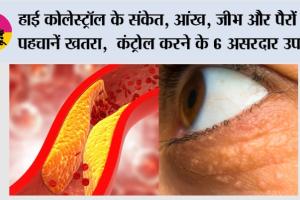 High Cholesterol Symptoms: हाई कोलेस्ट्रॉल के संकेत, आंख, जीभ और पैरों से पहचानें खतरा,  कंट्रोल करने के 6 असरदार उपाय