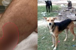 Dog Bite News: जनगणना ड्यूटी के दौरान अध्यापक को कुत्ते ने काटा