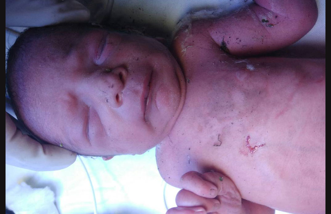 Newborn Baby, Bushes, Sensation, Hospital, Haryana