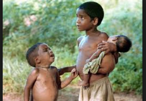Realize malnutrition free India