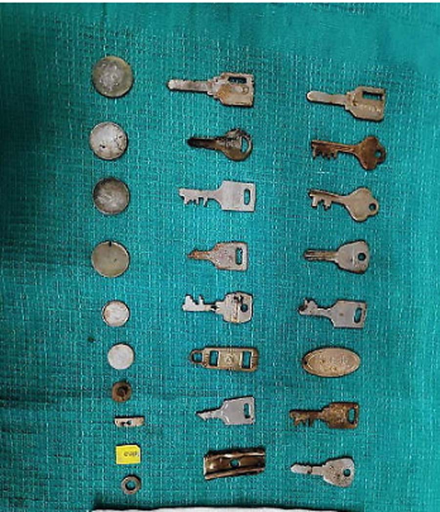 Coins, Sim, Card, Found, Stomach, Chennai 