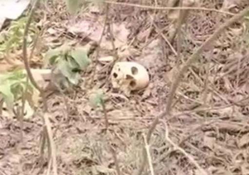 Human mill skeleton behind medical college