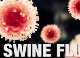 Swine Flu