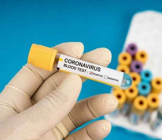 Coronavirus
